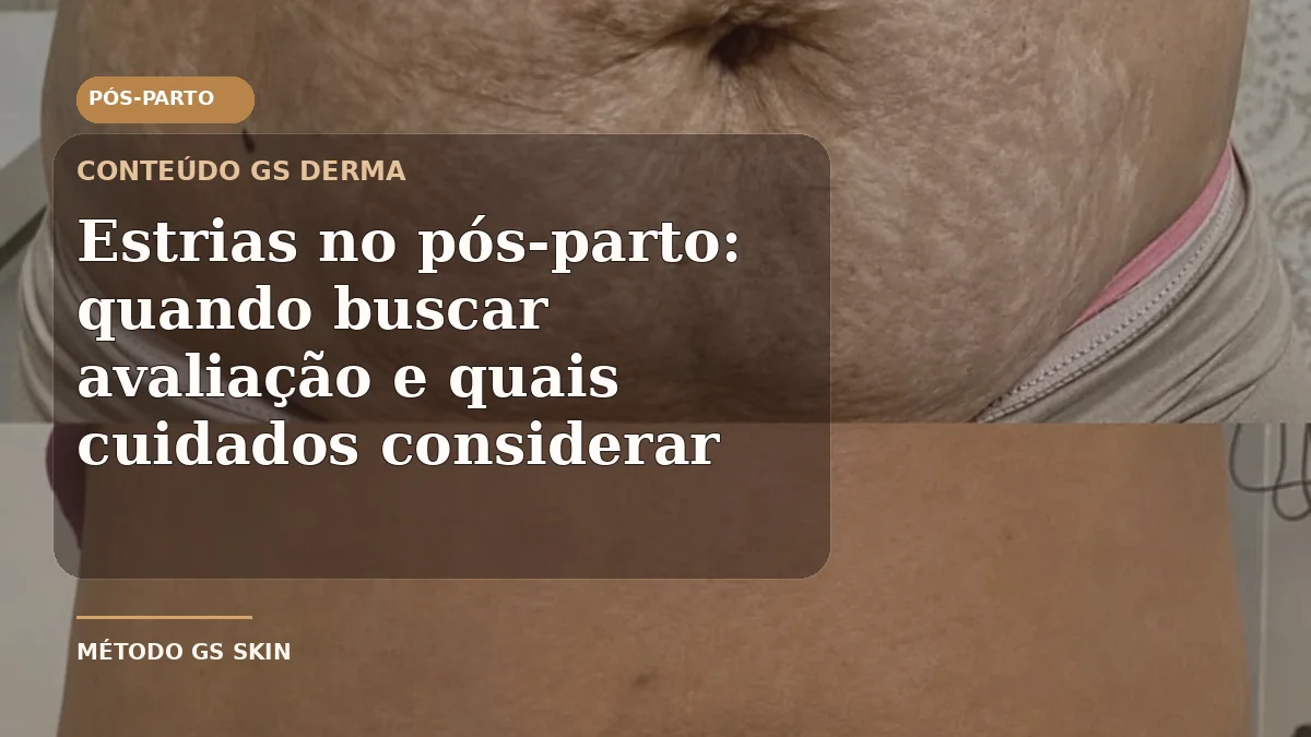 Região abdominal com estrias em conteúdo educativo sobre cuidados no pós-parto