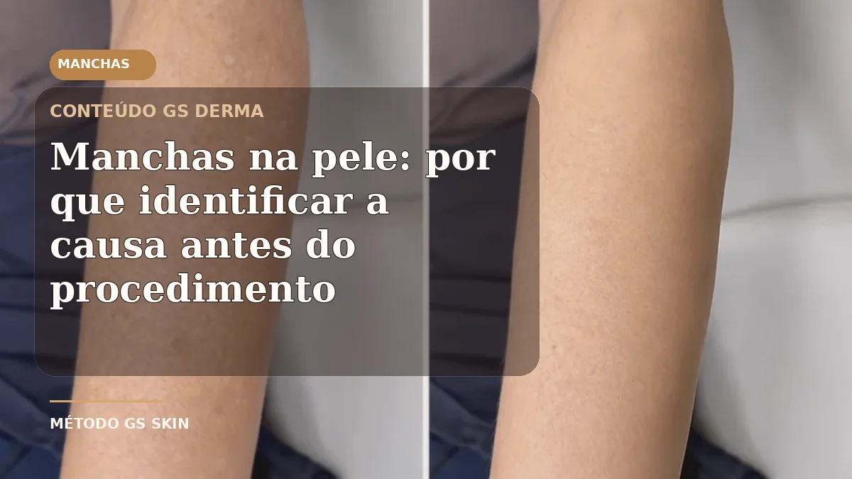 Antes e depois de alteração de tonalidade no braço em conteúdo sobre manchas na pele