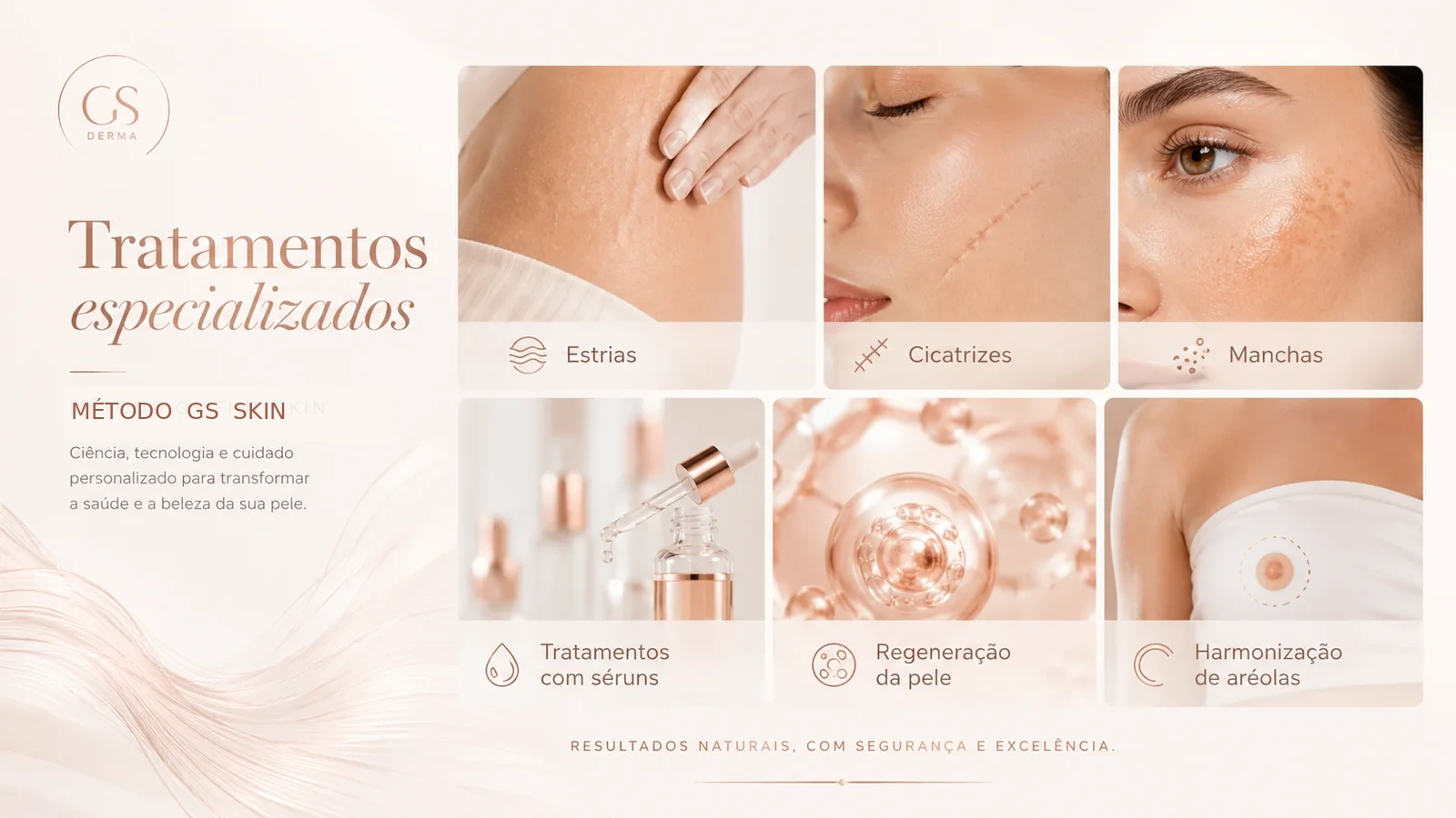 Tratamentos GS Skin para estrias, cicatrizes, manchas, séruns, regeneração e aréolas